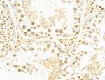 MMS19 Antibody in Immunohistochemistry (Paraffin) (IHC (P))