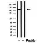 MMS19 Antibody in Western Blot (WB)