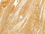 NAPRT1 Antibody in Immunohistochemistry (Paraffin) (IHC (P))