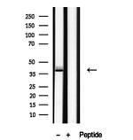 RBM4 Antibody in Western Blot (WB)