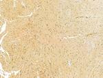 RCN2 Antibody in Immunohistochemistry (Paraffin) (IHC (P))