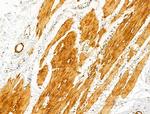 RCN2 Antibody in Immunohistochemistry (Paraffin) (IHC (P))