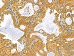 RCN2 Antibody in Immunohistochemistry (Paraffin) (IHC (P))