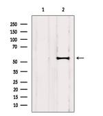 RCN2 Antibody in Western Blot (WB)