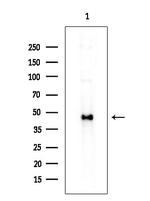 RCN2 Antibody in Western Blot (WB)