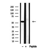 RCN2 Antibody in Western Blot (WB)