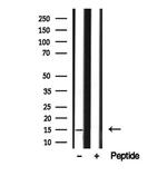 SNAPAP Antibody in Western Blot (WB)