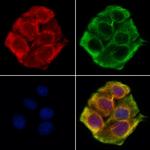 SPTLC2 Antibody in Immunocytochemistry (ICC/IF)