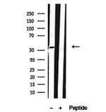 SPTLC2 Antibody in Western Blot (WB)