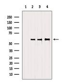 SRP68 Antibody in Western Blot (WB)