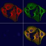 HRD1 Antibody in Immunocytochemistry (ICC/IF)