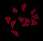 HRD1 Antibody in Immunocytochemistry (ICC/IF)