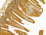 HRD1 Antibody in Immunohistochemistry (Paraffin) (IHC (P))