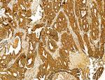 HRD1 Antibody in Immunohistochemistry (Paraffin) (IHC (P))