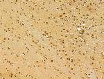 TLE3 Antibody in Immunohistochemistry (Paraffin) (IHC (P))