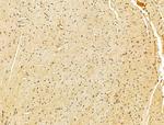 TLE3 Antibody in Immunohistochemistry (Paraffin) (IHC (P))