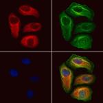 VPS16 Antibody in Immunocytochemistry (ICC/IF)