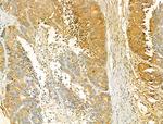 VPS16 Antibody in Immunohistochemistry (Paraffin) (IHC (P))