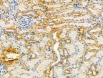 VPS16 Antibody in Immunohistochemistry (Paraffin) (IHC (P))