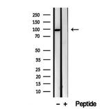 VPS16 Antibody in Western Blot (WB)