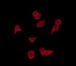 VPS37A Antibody in Immunocytochemistry (ICC/IF)