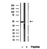 VPS37A Antibody in Western Blot (WB)