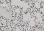 AEBP2 Antibody in Immunohistochemistry (Paraffin) (IHC (P))