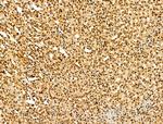 AEBP2 Antibody in Immunohistochemistry (Paraffin) (IHC (P))