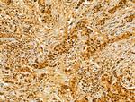 AEBP2 Antibody in Immunohistochemistry (Paraffin) (IHC (P))