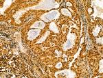 AEBP2 Antibody in Immunohistochemistry (Paraffin) (IHC (P))