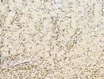 AEBP2 Antibody in Immunohistochemistry (Paraffin) (IHC (P))