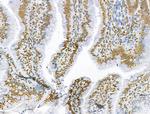 AEBP2 Antibody in Immunohistochemistry (Paraffin) (IHC (P))