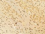 AEBP2 Antibody in Immunohistochemistry (Paraffin) (IHC (P))