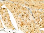 AEBP2 Antibody in Immunohistochemistry (Paraffin) (IHC (P))