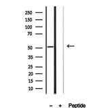 AEBP2 Antibody in Western Blot (WB)