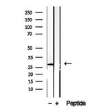 CHMP4B Antibody in Western Blot (WB)