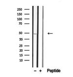 Activin A Antibody in Western Blot (WB)