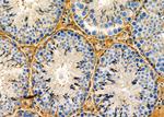 MDH1 Antibody in Immunohistochemistry (Paraffin) (IHC (P))