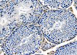 MDH1 Antibody in Immunohistochemistry (Paraffin) (IHC (P))