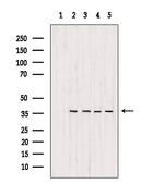 MDH1 Antibody in Western Blot (WB)