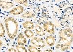 MEPCE Antibody in Immunohistochemistry (Paraffin) (IHC (P))