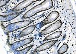 MEPCE Antibody in Immunohistochemistry (Paraffin) (IHC (P))