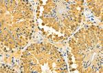 MGRN1 Antibody in Immunohistochemistry (Paraffin) (IHC (P))