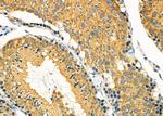 MGRN1 Antibody in Immunohistochemistry (Paraffin) (IHC (P))