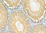 MGRN1 Antibody in Immunohistochemistry (Paraffin) (IHC (P))