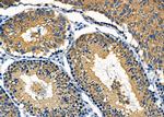 MGRN1 Antibody in Immunohistochemistry (Paraffin) (IHC (P))