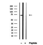 MGRN1 Antibody in Western Blot (WB)