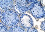 SEC24A Antibody in Immunohistochemistry (Paraffin) (IHC (P))