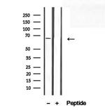 SEC24A Antibody in Western Blot (WB)