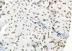 SFPQ Antibody in Immunohistochemistry (Paraffin) (IHC (P))